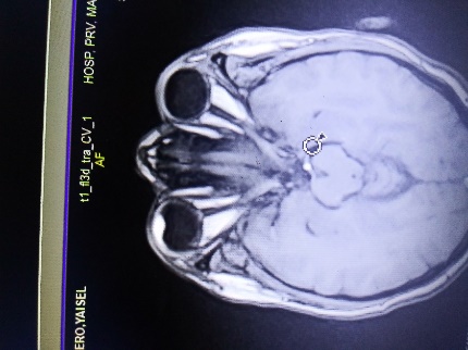 D:\Publicaciones\revista ciego\melanoma\melanoma\20241105_111324.jpg