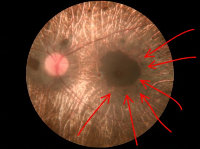 Imagen 1